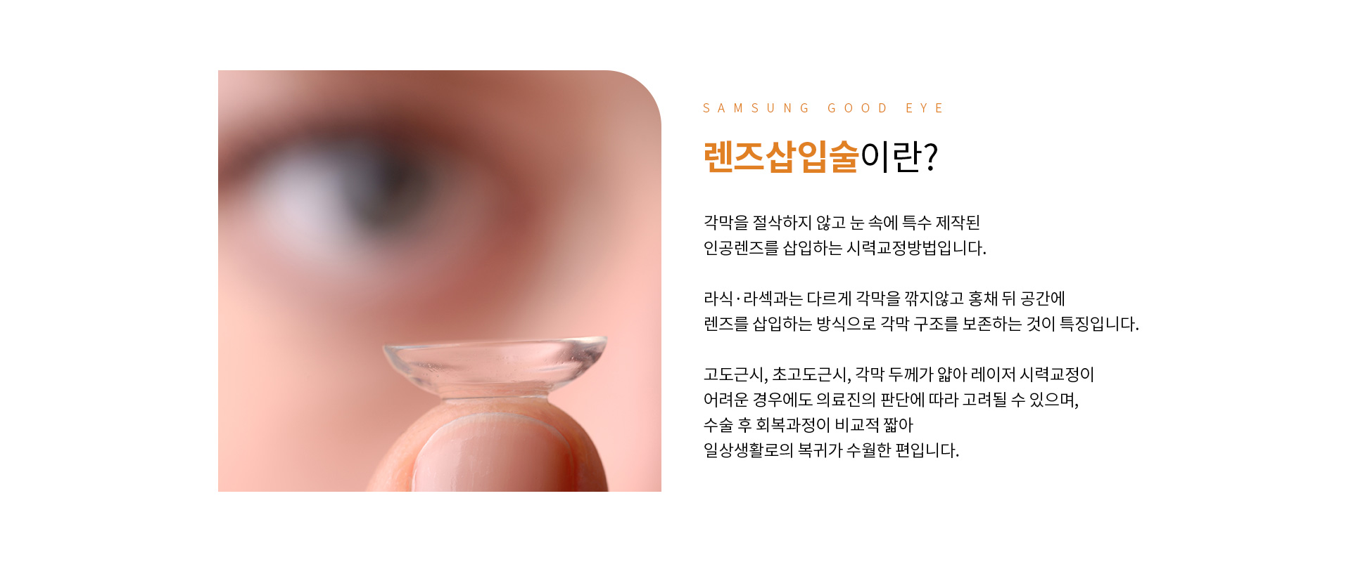 렌즈삽입술_01