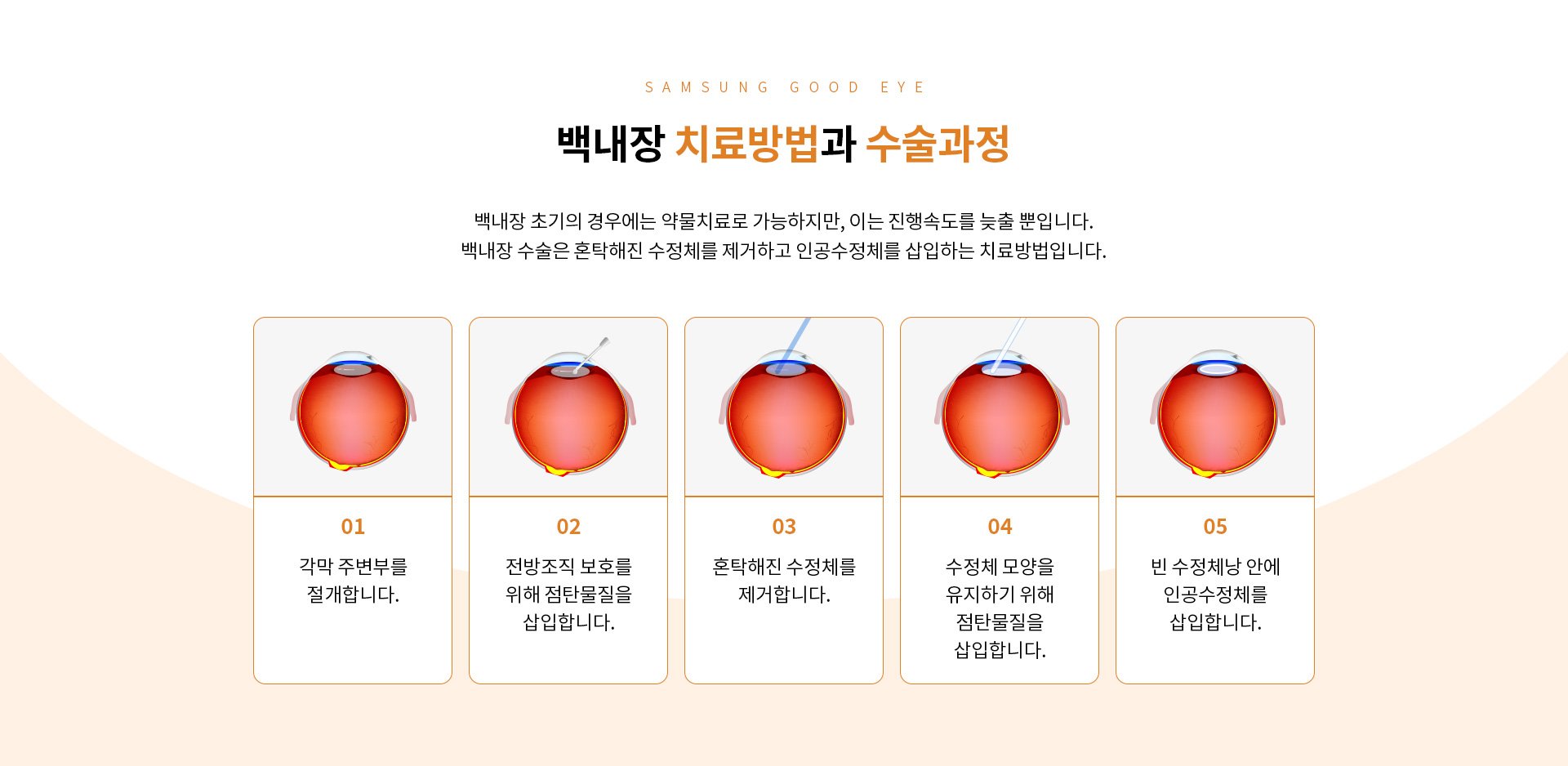 노안/백내장_04