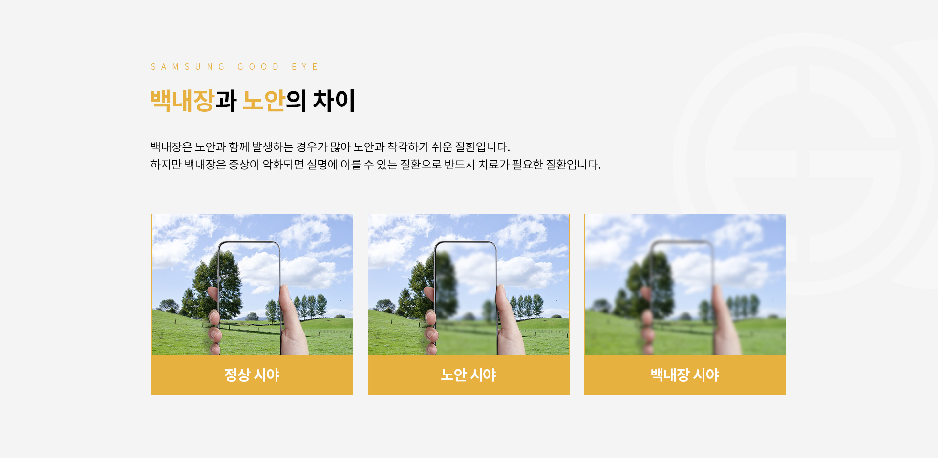 노안/백내장_06