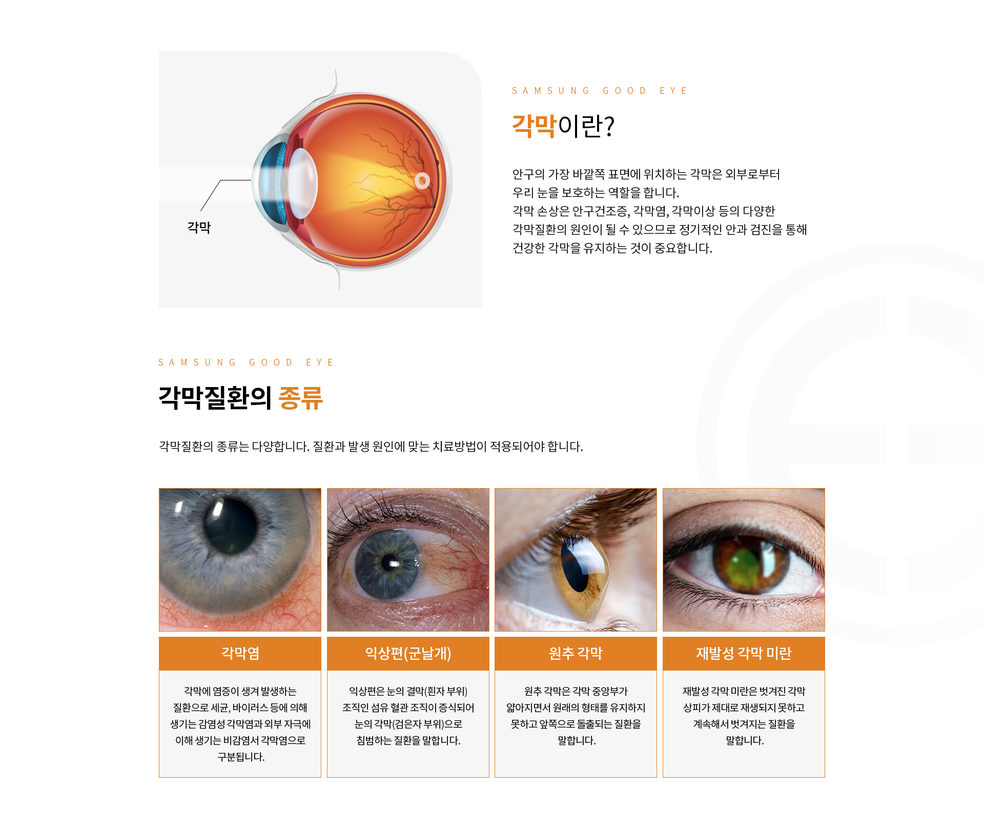 각막_01