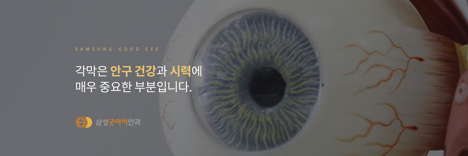 각막_02