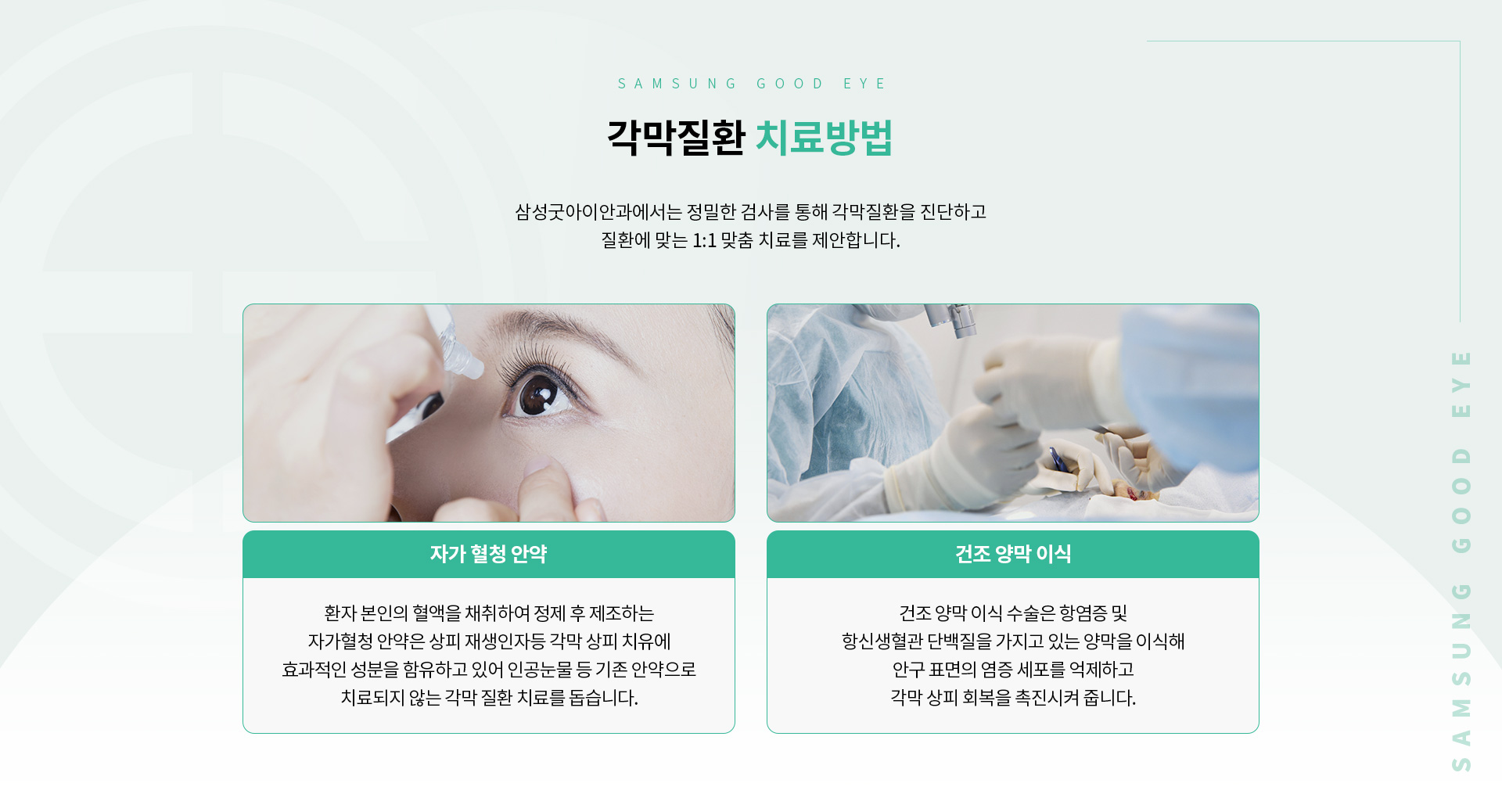 각막_04