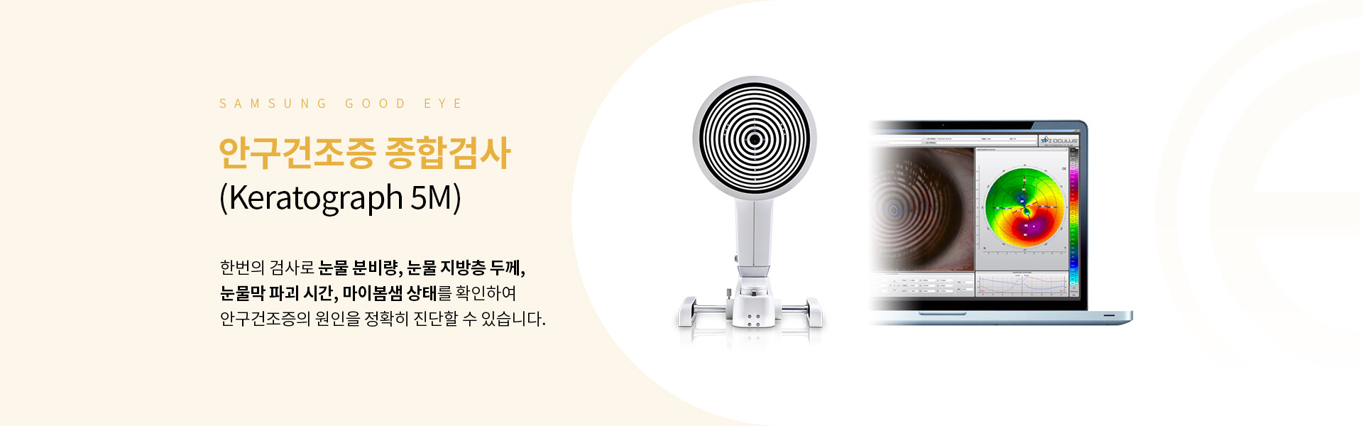 안구건조증_05