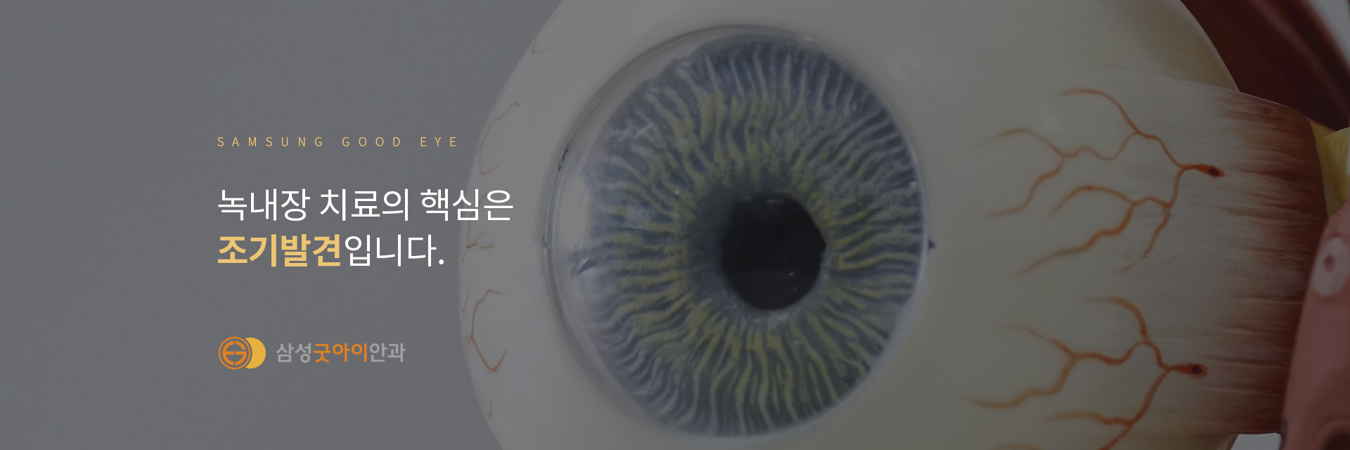 녹내장_04
