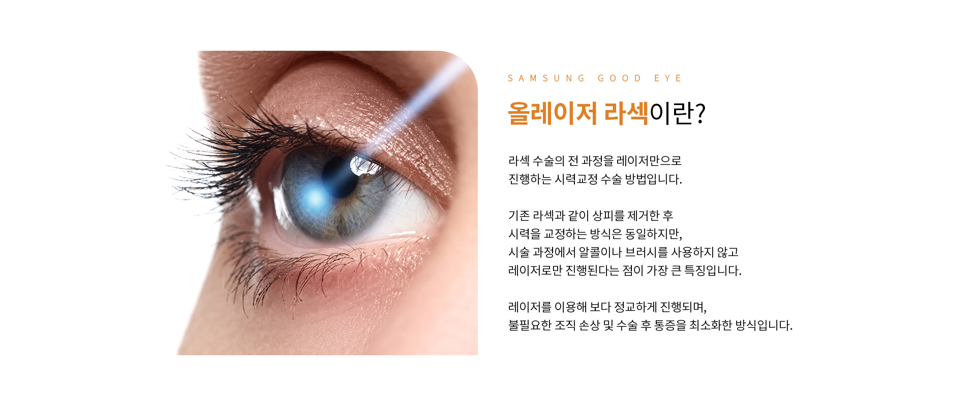 올레이저 라섹_02