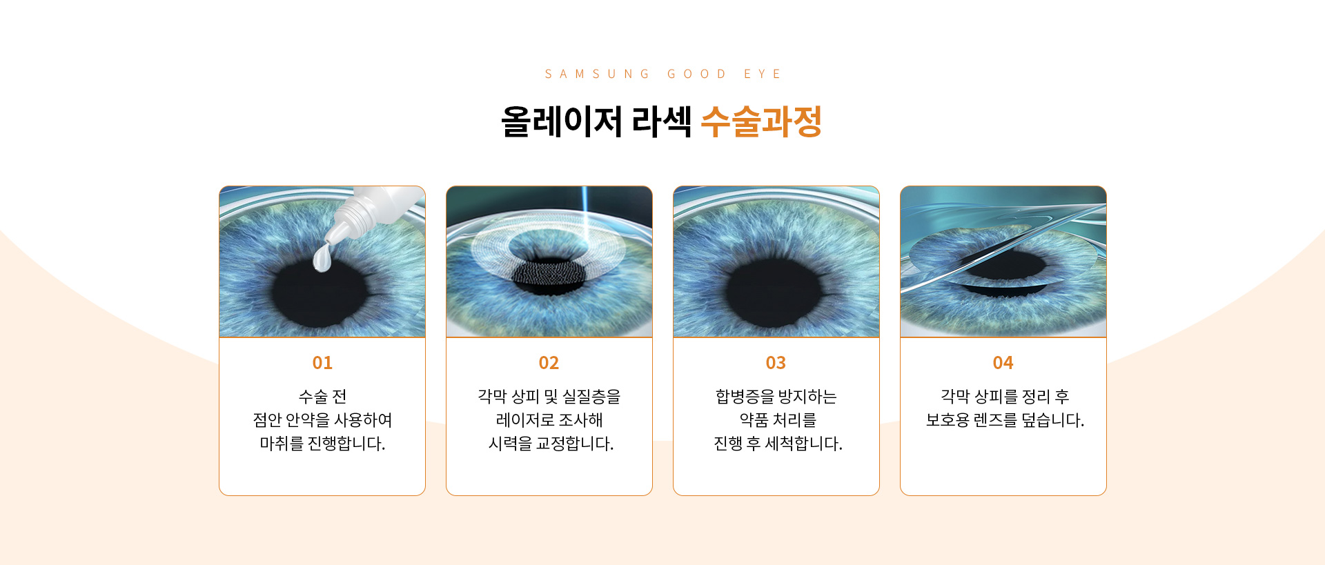 올레이저 라섹_06