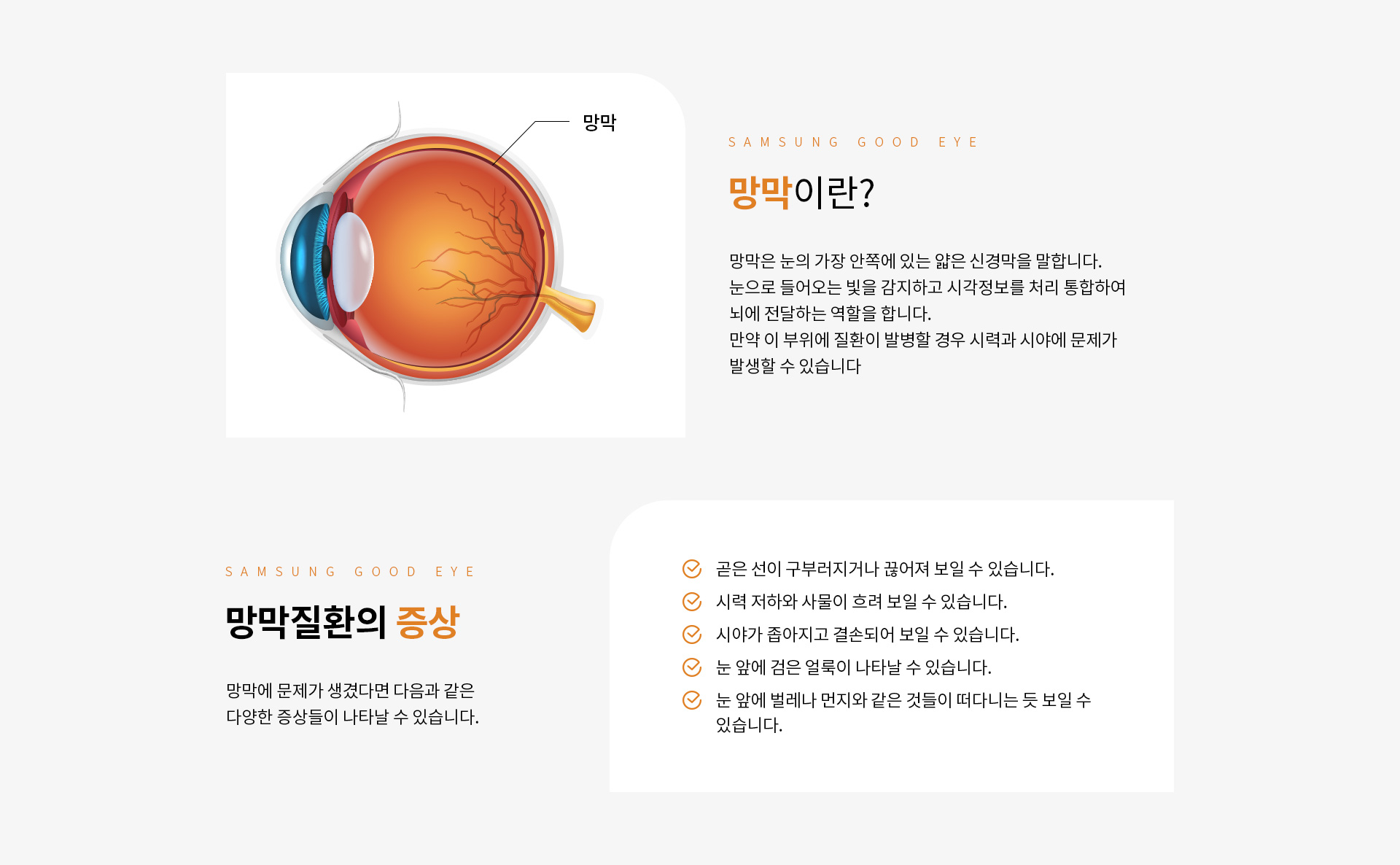 망막_01