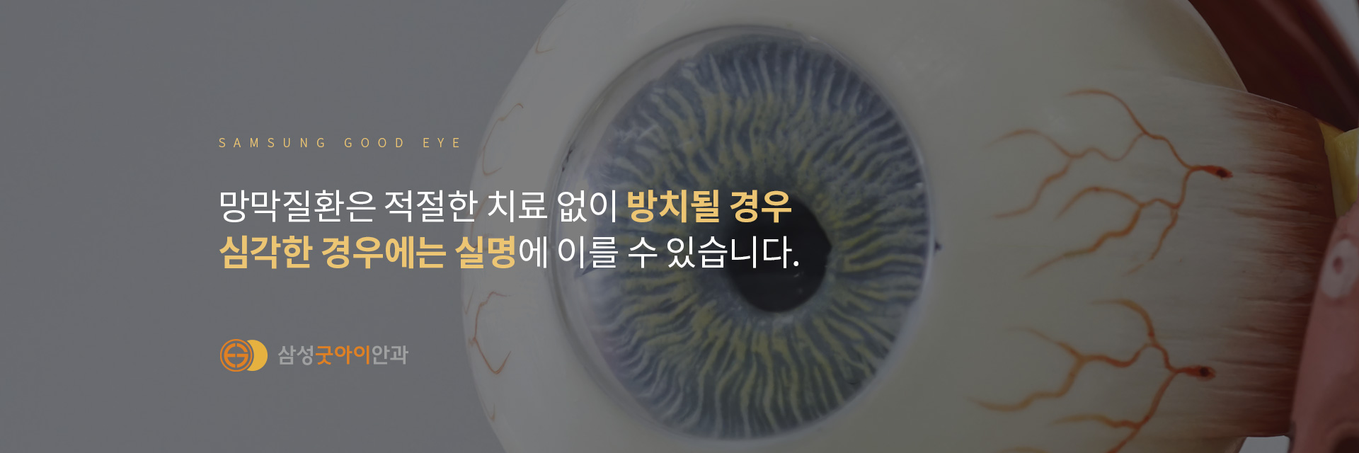 망막_03
